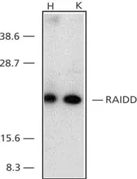 Anti-RAIDD antibody used in Western Blot (WB). GTX28426