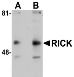Anti-RIP2 antibody used in Western Blot (WB). GTX28427