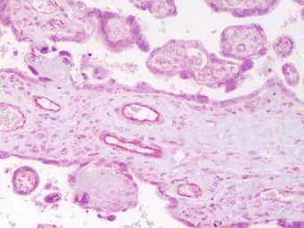 Anti-Angiopoietin 2 antibody used in IHC (Paraffin sections) (IHC-P). GTX28452