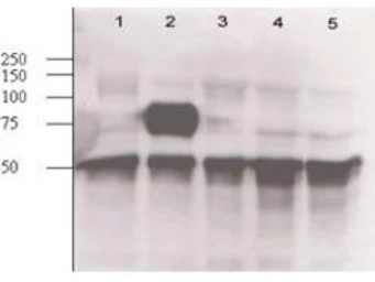 Anti-Angiopoietin 2 antibody used in Western Blot (WB). GTX28452