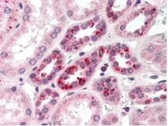 Anti-NOTCH2 antibody used in IHC (Paraffin sections) (IHC-P). GTX28927