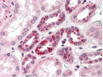 Anti-NOTCH2 antibody used in IHC (Paraffin sections) (IHC-P). GTX28927
