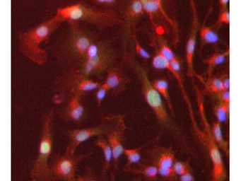 Anti-PPAR alpha antibody used in Immunocytochemistry/ Immunofluorescence (ICC/IF). GTX28934