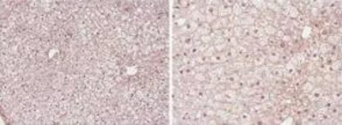 Anti-PPAR alpha antibody used in IHC (Paraffin sections) (IHC-P). GTX28934