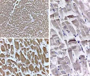 Anti-PPAR delta antibody used in Immunohistochemistry (IHC). GTX28937