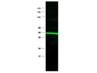 Anti-PPAR delta antibody used in Western Blot (WB). GTX28937