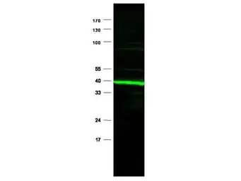 Anti-PPAR delta antibody used in Western Blot (WB). GTX28937