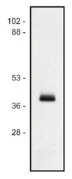 Anti-HLA Class I antibody [MEM-147] used in Western Blot (WB). GTX29090