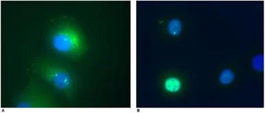 Anti-Daxx antibody [DAXX-01] used in Immunocytochemistry/ Immunofluorescence (ICC/IF). GTX29091