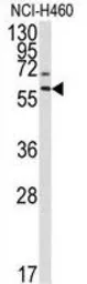 Anti-MMP17 antibody used in Western Blot (WB). GTX29125