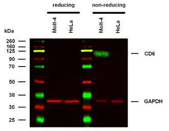 Anti-CD6 antibody [MEM-98] used in Western Blot (WB). GTX29181