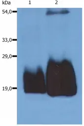 Anti-CD59 antibody [MEM-43/5] used in Western Blot (WB). GTX29183