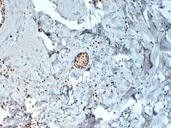 Anti-Estrogen Receptor alpha antibody [6F11] used in IHC (Paraffin sections) (IHC-P). GTX29269