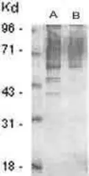 Anti-Phosphothreonine antibody used in Western Blot (WB). GTX29337