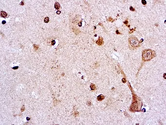 Anti-Pneumocystis carinii antibody [3F6] used in IHC (Paraffin sections) (IHC-P). GTX29531