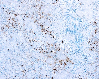 Anti-HSV1 antibody used in IHC (Paraffin sections) (IHC-P). GTX29533