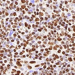 Anti-hnRNP M1-M4 antibody [1D8] used in IHC (Paraffin sections) (IHC-P). GTX29547