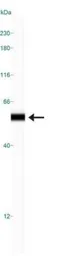 Anti-CUGBP1 antibody [3B1] used in Western Blot (WB). GTX29549
