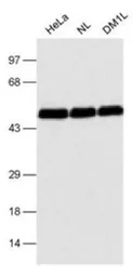 Anti-CUGBP1 antibody [3B1] used in Western Blot (WB). GTX29549