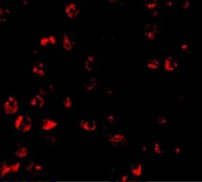 Anti-PUMA antibody used in Immunocytochemistry/ Immunofluorescence (ICC/IF). GTX29645