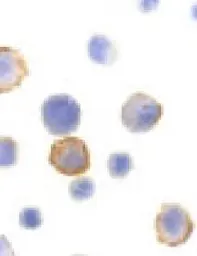 Anti-BMF antibody used in Immunocytochemistry/ Immunofluorescence (ICC/IF). GTX29655