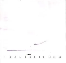 Anti-EGF antibody used in Western Blot (WB). GTX29695