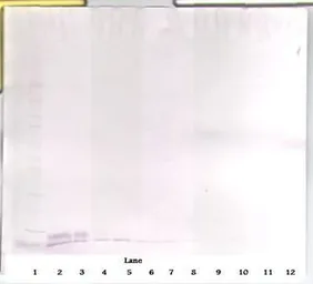 Anti-EGF antibody used in Western Blot (WB). GTX29695