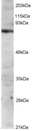 Anti-ITK antibody used in Western Blot (WB). GTX29707