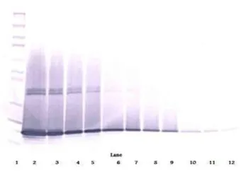 Anti-G-CSF antibody used in Western Blot (WB). GTX29751
