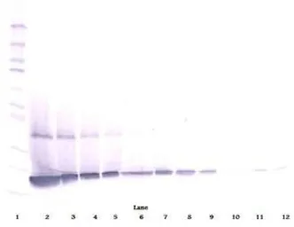 Anti-G-CSF antibody used in Western Blot (WB). GTX29751