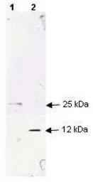 Anti-TGF beta 1 antibody used in Western Blot (WB). GTX29758