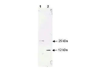 Anti-TGF beta 1 antibody used in Western Blot (WB). GTX29758