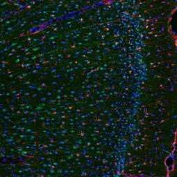 Anti-IL6 antibody used in IHC (Paraffin sections) (IHC-P). GTX29770