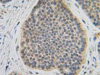 Anti-FGF10 antibody used in IHC (Paraffin sections) (IHC-P). GTX30007