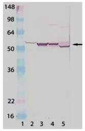 Anti-Cytochrome P450 antibody used in Western Blot (WB). GTX30013