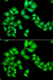 Anti-Aladin antibody used in Immunocytochemistry/ Immunofluorescence (ICC/IF). GTX30014