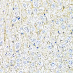 Anti-ABCA6 antibody used in IHC (Paraffin sections) (IHC-P). GTX30015