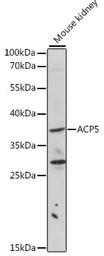 Anti-TRAP antibody used in Western Blot (WB). GTX30018