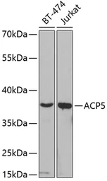 Anti-TRAP antibody used in Western Blot (WB). GTX30018