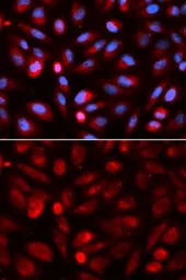 Anti-TRAP antibody used in Immunocytochemistry/ Immunofluorescence (ICC/IF). GTX30018