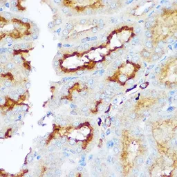 Anti-TRAP antibody used in IHC (Paraffin sections) (IHC-P). GTX30018