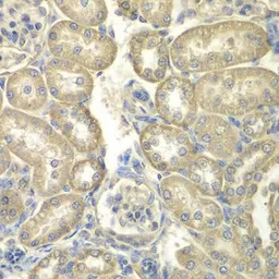 Anti-ACSL5 antibody used in IHC (Paraffin sections) (IHC-P). GTX30019