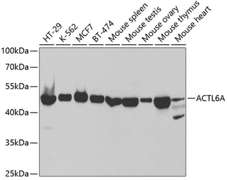 Anti-BAF53A antibody used in Western Blot (WB). GTX30021