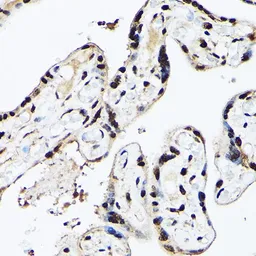 Anti-BAF53A antibody used in IHC (Paraffin sections) (IHC-P). GTX30021