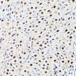 Anti-BAF53A antibody used in IHC (Paraffin sections) (IHC-P). GTX30021