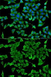 Anti-Arp2 antibody used in Immunocytochemistry/ Immunofluorescence (ICC/IF). GTX30022