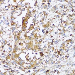 Anti-Arp2 antibody used in IHC (Paraffin sections) (IHC-P). GTX30022