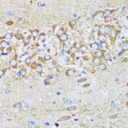 Anti-Arp2 antibody used in IHC (Paraffin sections) (IHC-P). GTX30022