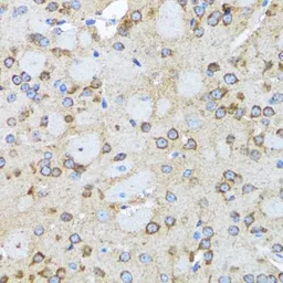 Anti-Arp2 antibody used in IHC (Paraffin sections) (IHC-P). GTX30022
