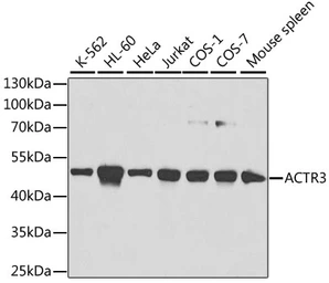 Anti-Arp3 antibody used in Western Blot (WB). GTX30023